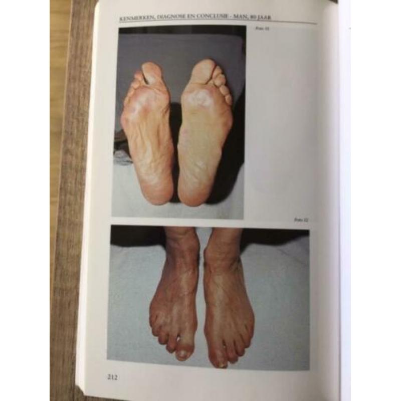 voetreflex massage